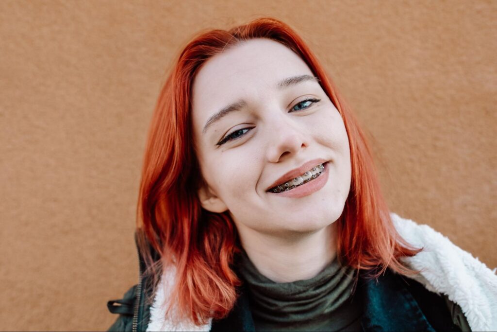 Are Metal Braces Still a Good Option?